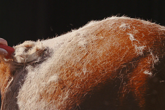 Understanding Shock Loss and Hair Shedding After a Hair Transplant